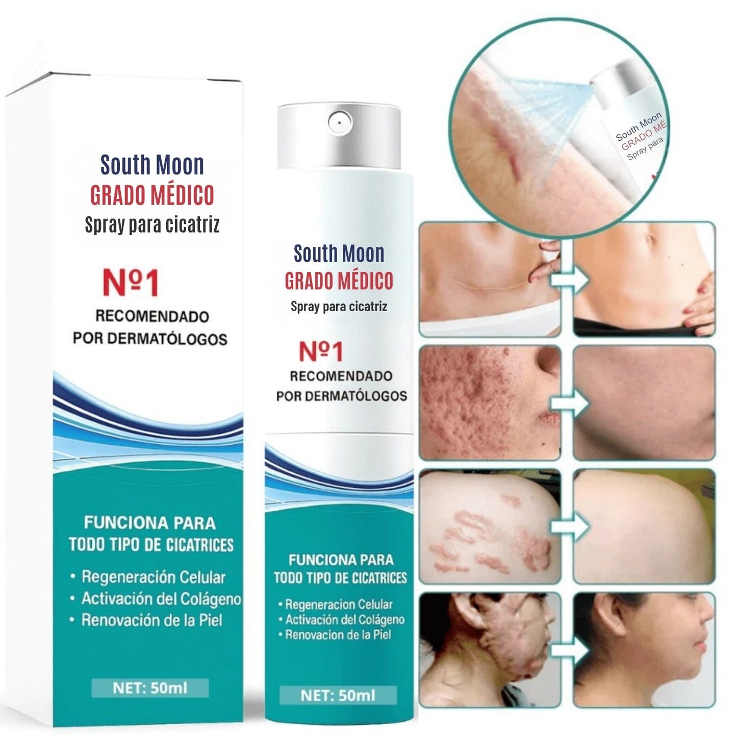2x1 South Moon | Spray Elimina Cicatrices + E-book Gratis