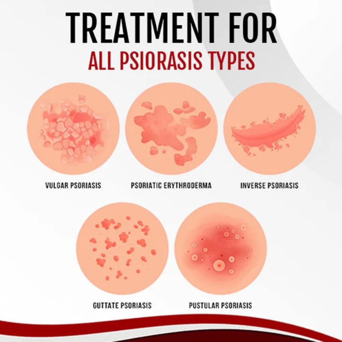 2x1 Spray Eliminación Psoriasis